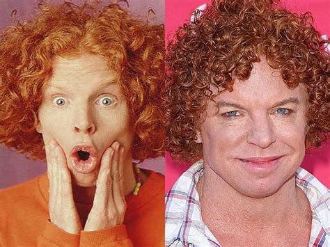 carrot top celebrity plastic surgery disasters pictures cbs news