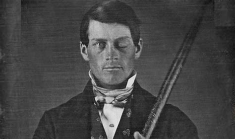 The Curious Case Of Phineas Gage Ep71 Hub History Boston History