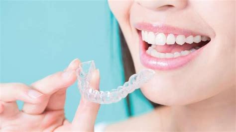 Benefits Of Invisalign Invisalign Clear Braces Germantown Md