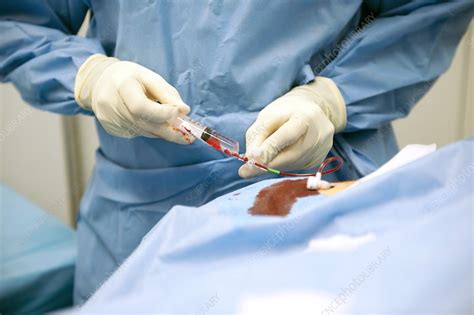 Coronary Angioplasty Surgery Stock Image C0097219 Science Photo
