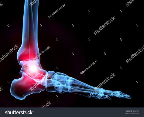 Powerpoint Template Foot Ankle Anatomy Human Kklhmup