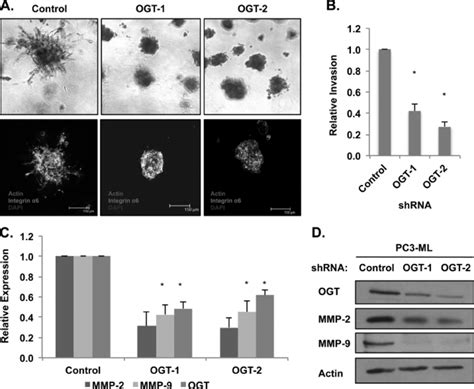 Targeting Ogt Decreases Invasive Phenotypes In Vitro A Bright Field