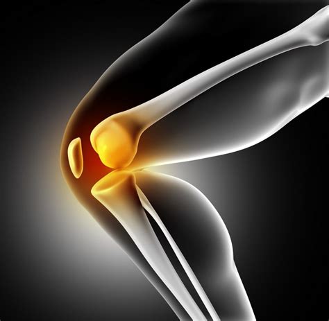 Know Your Pain 4 Common Causes Of Knee Pain Part 2 Orlando Walters Dpt