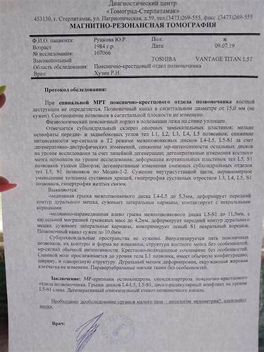 Межпозвоночная грыжа пояснично-крестцового отдела - Вопрос нейрохирургу Картинка - Межпозвоночная грыжа пояснично-крестцового отдела - Вопрос нейрохирургу