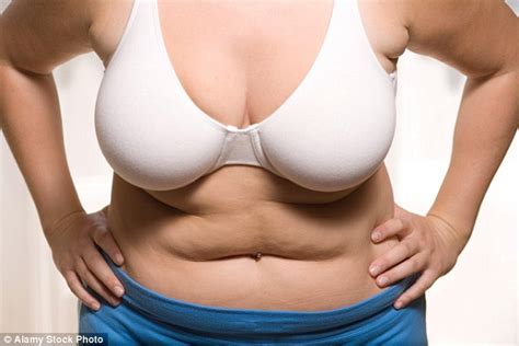 Nhs Breast Reductions For Obese Women Cost Taxpayers £1m A Year Daily