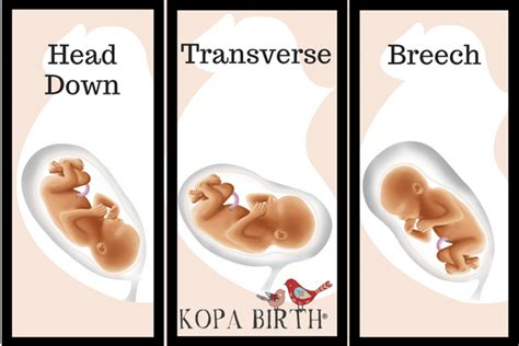 How To Tell If Baby Is Head Down Kopa Birth