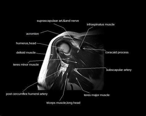 Overuse injuries of the knee include tendonitis, bursitis, muscle strains, and iliotibial band syndrome. Image result for mri anatomy shoulder | Shoulder anatomy ...