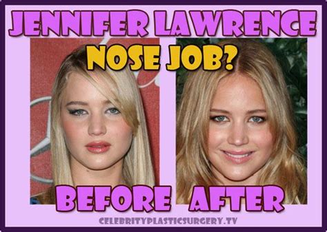Jennifer Lawrence Plastic Surgery Nose Job Before And After Jennifer Lawrence Plastic Surgery