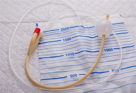 Using Foley Bulb For Labour Induction Benefits Procedure And Risks