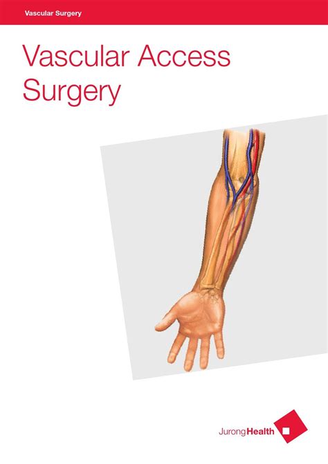 Vascular Surgery Vascular Access Surgery By Juronghealth Campus Issuu