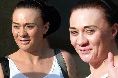 Devastated Josie Cunningham Turned Down For Nose Job She Aborted Her