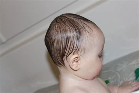 Bulging Above Ears Normal Head Shape Babycenter