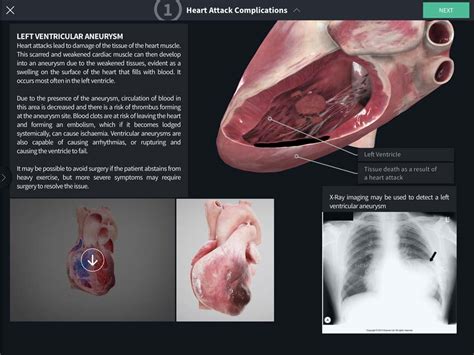 Clinical Correlates Of The Heart Complete Anatomy