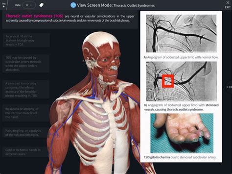 Abrahams Clinical Human Anatomy Complete Anatomy