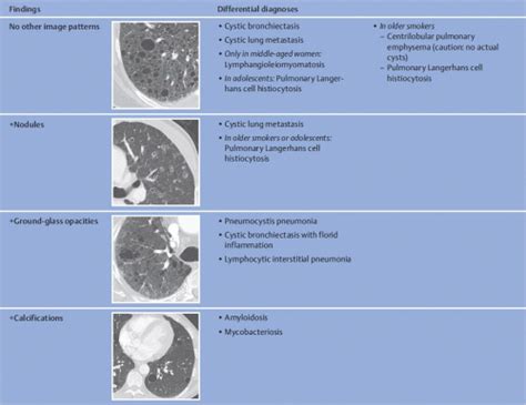 Diagnostic Schema For Typical Computed Tomography Findings Of Diffuse