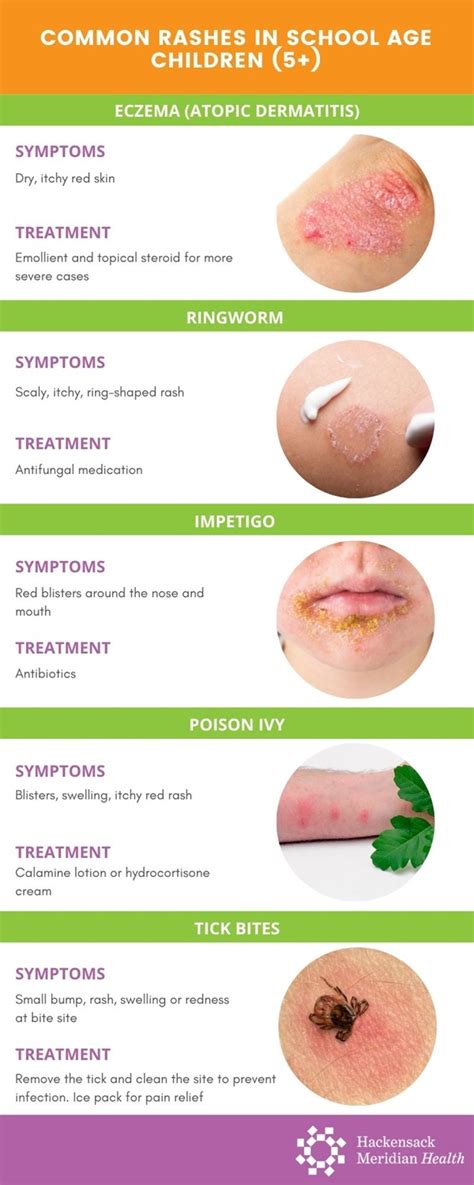 Common Rashes In Kids And What To Do