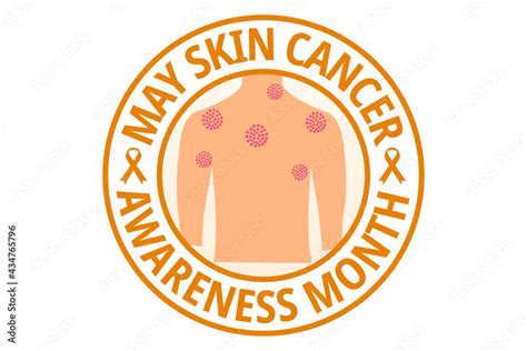 Skin Cancer Awareness Month Flat Vector Illustration A Health Design