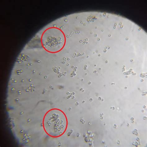 Microscopio Diy Para Levadura Cerveza Con Cámara Para El Recuento