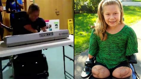 This Girl Lost All Four Limbs Due To A Deadly Bacterial Disease But That Didnt Classic Fm