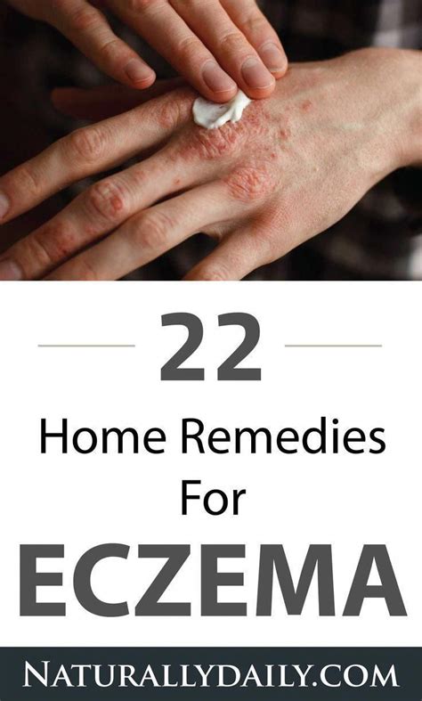 How To Get Rid Of Eczema 11 Natural Ways You May Try It Is Not Easy To