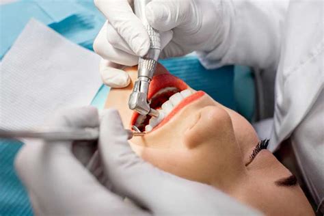 Le Curetage Dentaire Quest Ce Que Cest Sanz Clínica Dental
