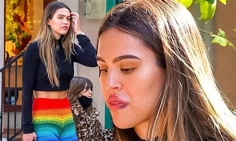 Amelia Hamlin Is Pictured With Bruising Around Her Puffed Up Pout With