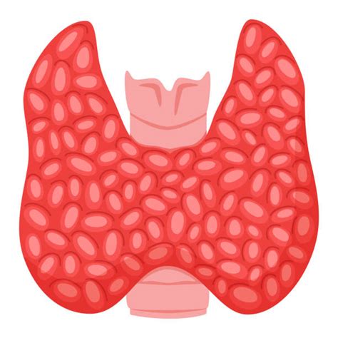 Goiter Drawings Illustrations Royalty Free Vector Graphics And Clip Art