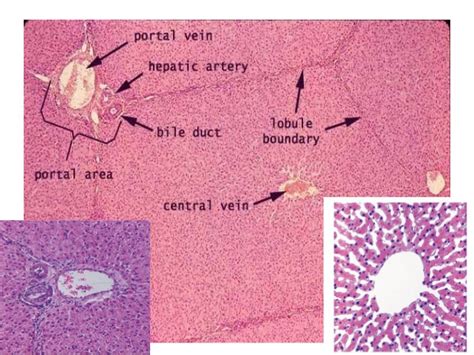 High Yield Liver Pathology A Pattern Based Approach To The Liver Biopsy