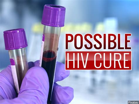 Possible Hiv Cure Study Eliminates Virus In Mice Nbc Palm Springs