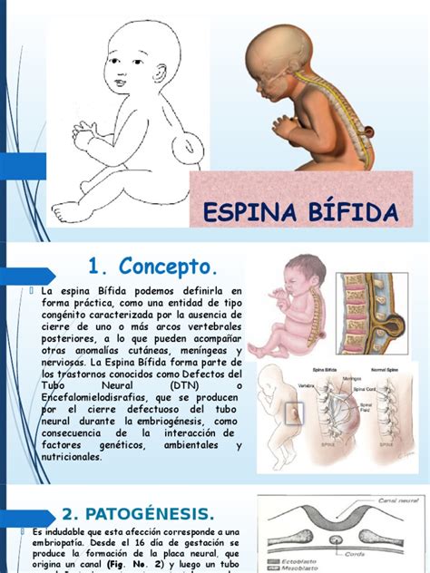 Espina Bífida Pdf Especialidades Medicas Medicina Clinica