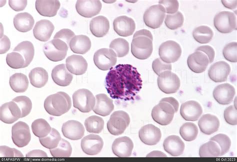 Stock Image Photomicrograph Of A Normal Human Blood Smear Showing One