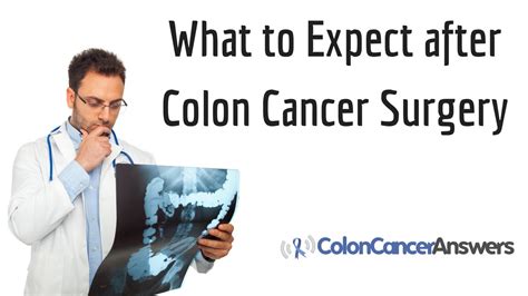 What To Expect After Colon Cancer Surgery Youtube