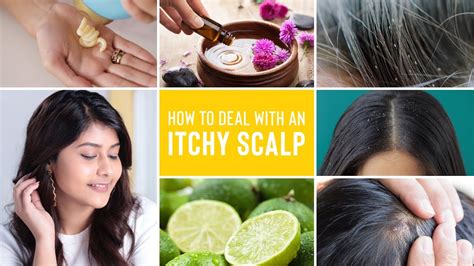 Itchy Scalp Treatments Remedies For Dandruff Lice And Scalp Acne