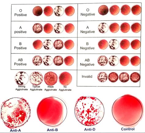 Blood Type Chart A Positive