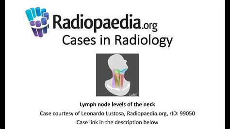 Lymph Node Levels Of The Neck Cases In Radiology
