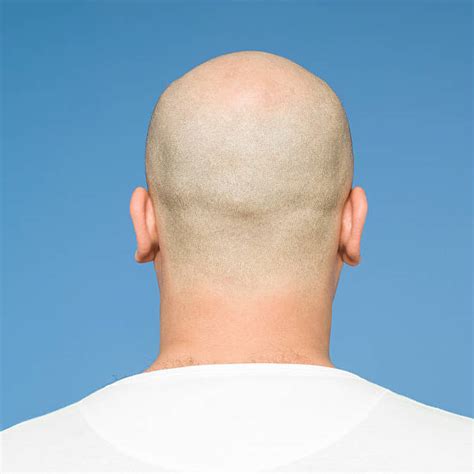 Male Shaved Head Completely Bald Human Head Stock Photos Pictures