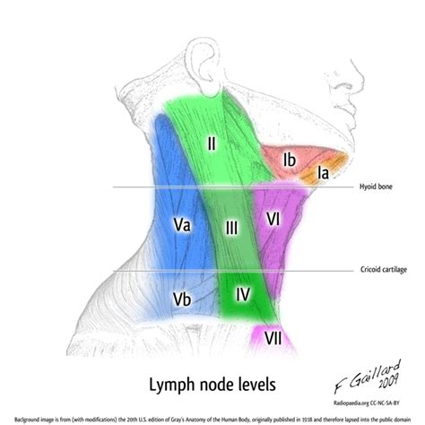 Cervical Lymph Node Diagram Clinical Guide Wiki