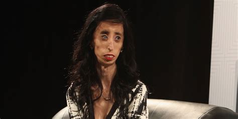 The Woman Who Went Viral As The Worlds Ugliest Woman Talks About Her