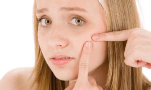 Should you at all use colloidal to treat acne? Pimples, Boils & Acne Treatment | Natural Antibiotics