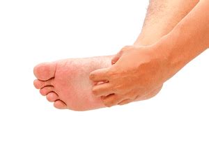 Why Pimple Bottom Foot Sole Telegraph