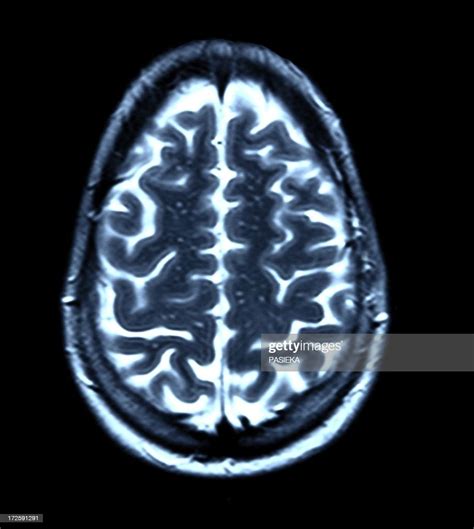 Brain Scan Mri Scan High Res Stock Photo Getty Images