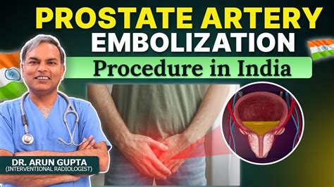 Prostate Artery Embolization Pae Procedure In India Treatment Overview Youtube