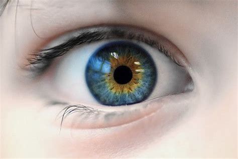 Sectoral Heterochromia Beautiful Eyes Color Stunning Eyes Pretty Eyes