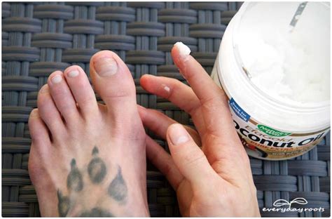 Follow the given instructions to use it accurately and in a beneficial way. 3 Simple Home Remedies for Toenail Fungus | Everyday Roots
