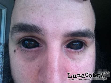 A sclera tattoo is a tattoo on the white area of the eyeball. Black_eyeball_tattoo | Body mods, Sclera tattoo