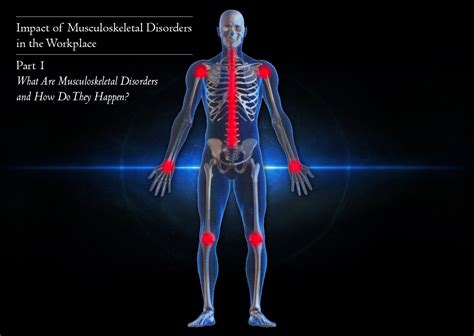 What Are Musculoskeletal Disorders And How Do They Happen