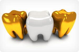 Maybe you would like to learn more about one of these? Dentist for Dental Crowns in Hoover AL & Birmingham AL ...