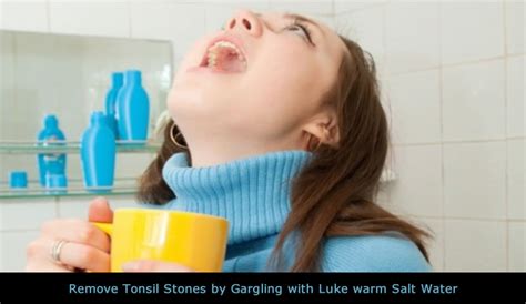 Waterpik For Tonsil Stones Removal Guide Waterpik For Tonsil Stones