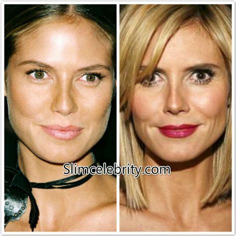 Heidi Klum Plastic Surgery Before And After Photos Nose Job Breast