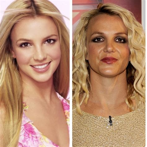 Britney Spears Before And After Cosmetic Surgery Verge Campus